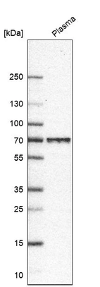 Western blot analysis in human plasma.