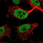 Anti-ZBTB21 Antibody