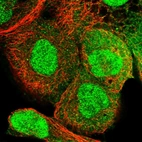 Immunofluorescent staining of human cell line A-431 shows localization to nucleus & cytosol.