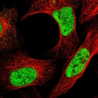Immunofluorescent staining of human cell line U-2 OS shows localization to nuclear speckles.