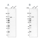 Western blot analysis using Anti-DDX42 antibody HPA025941 (A) shows similar pattern to independent antibody HPA023571 (B).