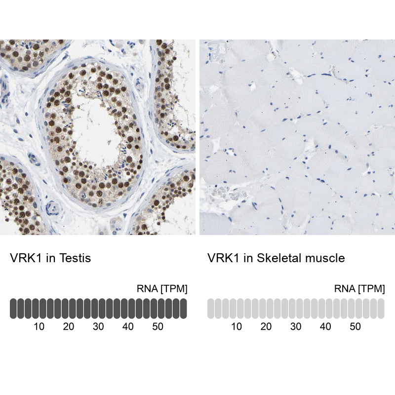 Anti-VRK1 Antibody