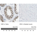 Anti-VRK1 Antibody
