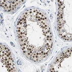 Immunohistochemical staining of human testis shows strong nuclear positivity in cells in seminiferous ducts.