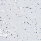 Immunohistochemical staining of human skeletal muscle shows no positivity in myocytes as expected.