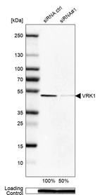Western blot analysis in Rh30 cells transfected with control siRNA, target specific siRNA probe #1, using Anti-VRK1 antibody. Remaining relative intensity is presented. Loading control: Anti-PPIB.