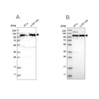 Western blot analysis using Anti-IARS2 antibody HPA024594 (A) shows similar pattern to independent antibody HPA024212 (B).
