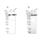 Western blot analysis using Anti-IARS2 antibody HPA024594 (A) shows similar pattern to independent antibody HPA024212 (B).