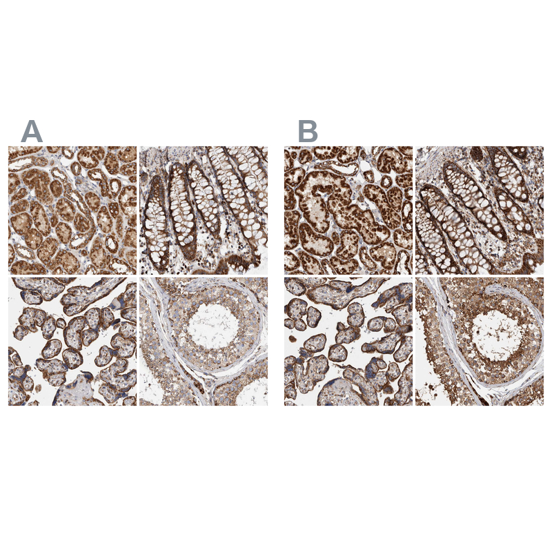 Anti-IARS2 Antibody