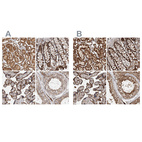 Anti-IARS2 Antibody