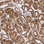 Immunohistochemical staining of human kidney shows strong granular cytoplasmic positivity in cells in tubules.