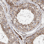Immunohistochemical staining of human testis shows moderate granular cytoplasmic positivity in cells in seminiferous ducts.