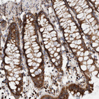 Immunohistochemical staining of human rectum shows strong granular cytoplasmic positivity in glandular cells.