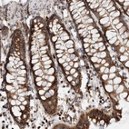 Immunohistochemical staining of human rectum shows strong granular cytoplasmic positivity in glandular cells.