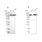Western blot analysis using Anti-IARS2 antibody HPA024212 (A) shows similar pattern to independent antibody HPA024594 (B).