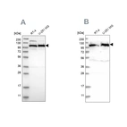 Western blot analysis using Anti-IARS2 antibody HPA024212 (A) shows similar pattern to independent antibody HPA024594 (B).