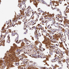 Immunohistochemical staining of human lung shows moderate granular cytoplasmic positivity in macrophages.