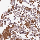 Immunohistochemical staining of human lung shows moderate granular cytoplasmic positivity in macrophages.