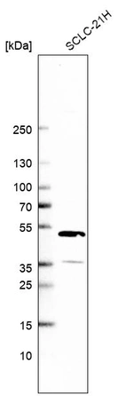 Western blot analysis in human cell line SCLC-21H.