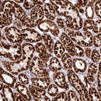 Immunohistochemical staining of human kidney shows strong granular cytoplasmic positivity in cells in tubules.