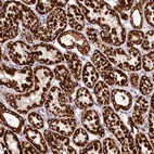 Immunohistochemical staining of human kidney shows strong granular cytoplasmic positivity in cells in tubules.