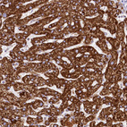 Immunohistochemical staining of human liver shows strong granular cytoplasmic positivity in hepatocytes.