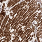 Immunohistochemical staining of human heart muscle shows strong cytoplasmic positivity in cardiomyocytes.