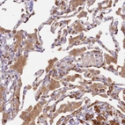 Immunohistochemical staining of human lung shows moderate granular cytoplasmic positivity in macrophages.