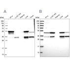 Western blot analysis using Anti-CLYBL antibody HPA040691 (A) shows similar pattern to independent antibody HPA039959 (B).