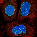 Immunofluorescent staining of human cell line A-431 shows localization to nuclear membrane.