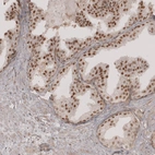 Immunohistochemical staining of human prostate shows moderate to strong nuclear positivity in glandular cells.