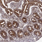 Immunohistochemical staining of human small intestine shows strong cytoplasmic positivity in glandular cells.