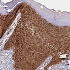 Immunohistochemical staining of human skin shows strong cytoplasmic granular - nucleoli in squamous epithelial cells.