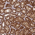 Immunohistochemical staining of human kidney shows strong cytoplasmic granular positivity in cells in tubules.