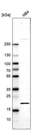 Western blot analysis in human cell line NB4.