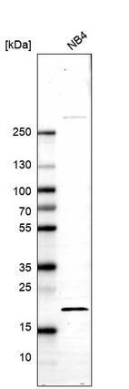 Western blot analysis in human cell line NB4.
