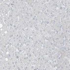 Immunohistochemical staining of human liver shows no positivity in hepatocytes as expected.