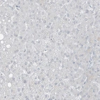 Immunohistochemical staining of human liver shows no positivity in hepatocytes as expected.