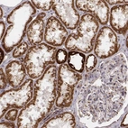 Immunohistochemical staining of human kidney shows strong cytoplasmic positivity in cells in tubules.