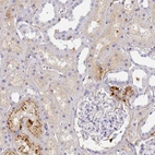 Immunohistochemical staining of human kidney shows moderate cytoplasmic positivity in cells in tubules.