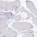Immunohistochemical staining of human skeletal muscle shows no positivity in myocytes as expected.