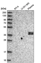 Western blot analysis in human cell line RT-4, human cell line U-251 MG and human plasma.