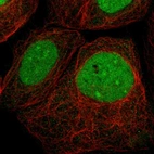 Immunofluorescent staining of human cell line A-431 shows localization to nucleus & nucleoli.