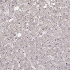 Immunohistochemical staining of human liver shows no positivity in hepatocytes as expected.