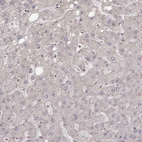 Immunohistochemical staining of human liver shows no positivity in hepatocytes as expected.