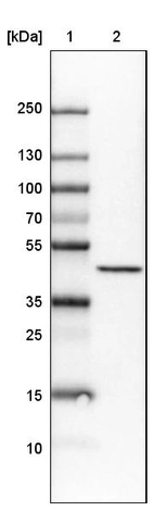 Lane 1: Marker [kDa]_br/_Lane 2:Human cell line U-251 MG