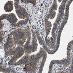 Immunohistochemical staining of human fallopian tube shows strong cytoplasmic positivity in glandular cells.