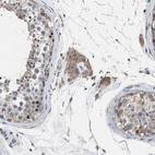 Immunohistochemical staining of human testis shows strong cytoplasmic positivity in Leydig cells.