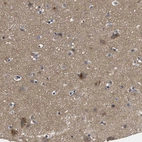 Immunohistochemical staining of human cerebral cortex shows strong cytoplasmic granular positivity in neurons.