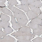 Immunohistochemical staining of human skeletal muscle shows no cytoplasmic positivity in myocytes as expected.